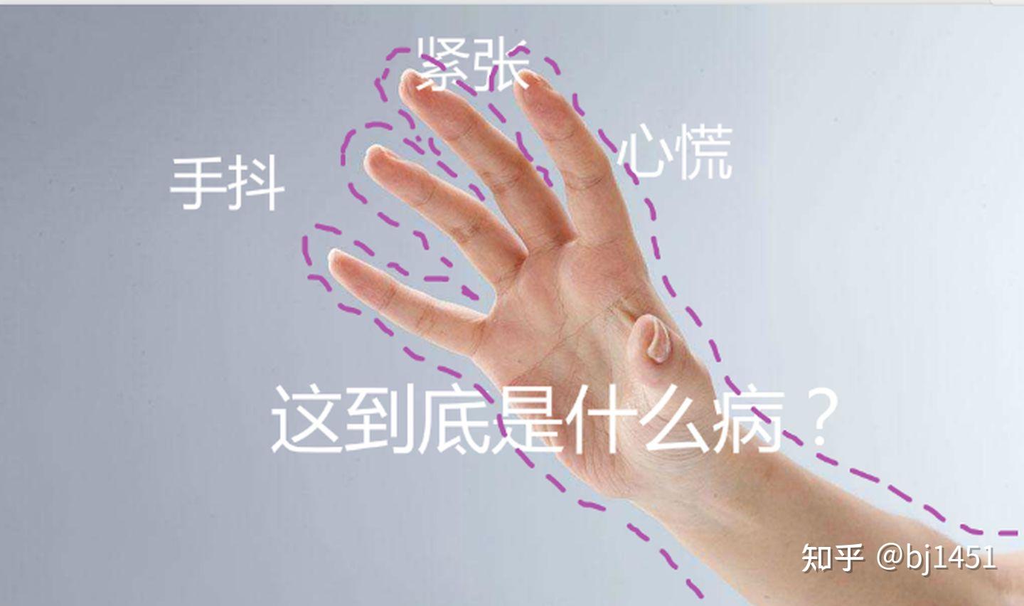 一篇文章解读特发性震颤