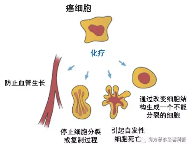 如何化疗图片