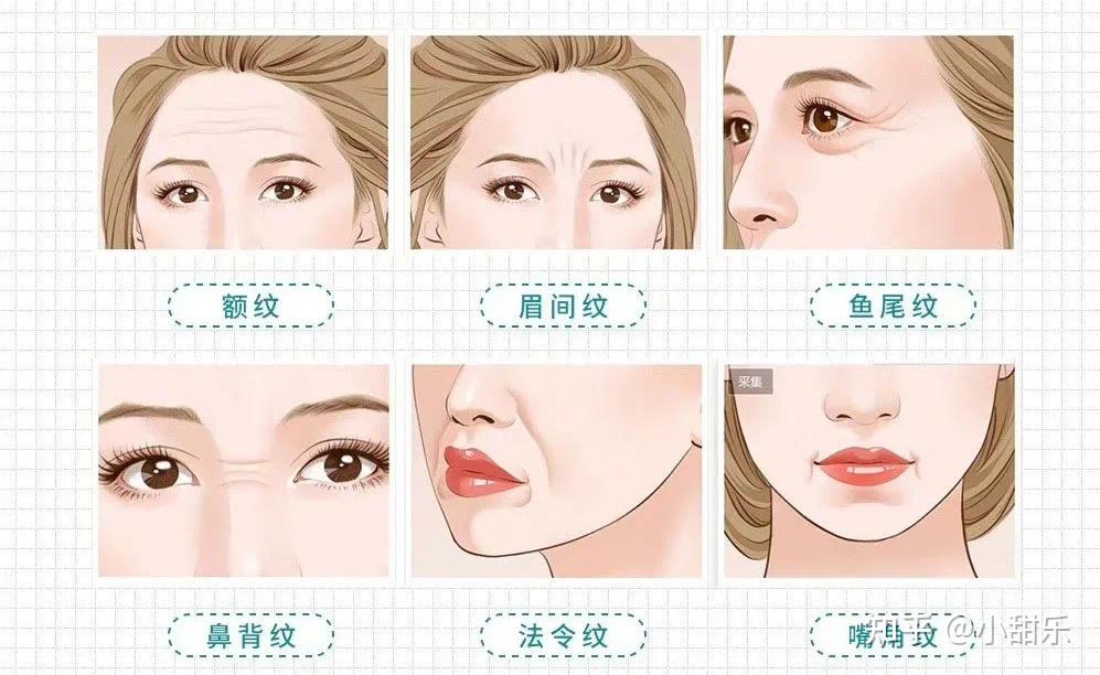 童颜针和少女针的区别和对比