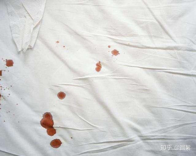 正常的月经期间,也会伴随着偶尔的小血块的出现.