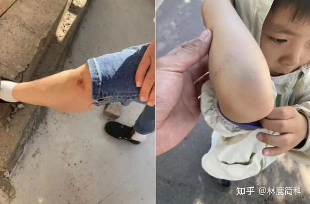 河南一位58岁奶奶骑电动车去接6岁孙子放学,NFC解锁后刚骑出几米,车把突然锁死,祖孙俩瞬间连人带车重重摔在马路中央。