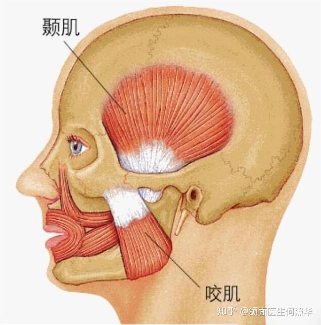 颞肌肥大图片