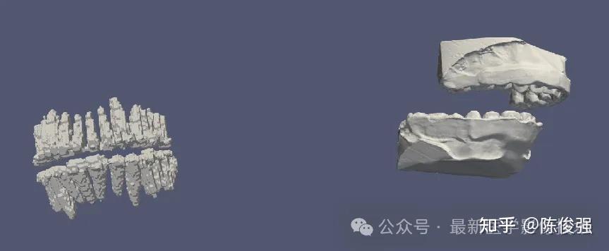 STSR2025——CBCT牙齿分割和CBCT与IOS注册配准 - 知乎