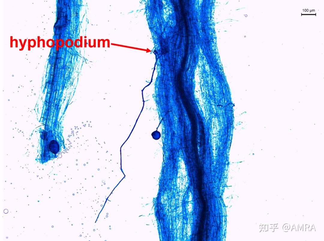 丛枝菌根显微镜图片