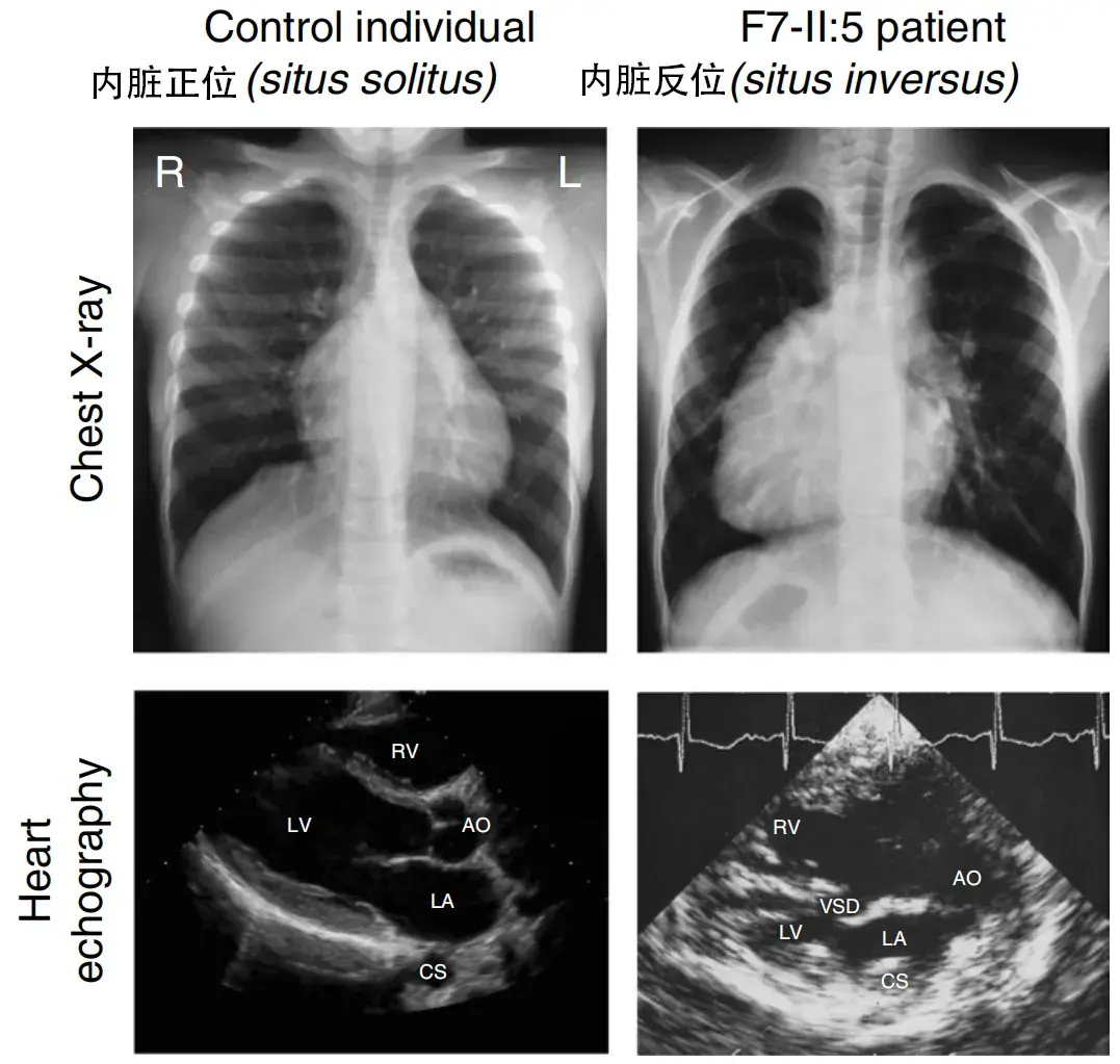 心脏为什么长在左边原来是因为这个消失的器官