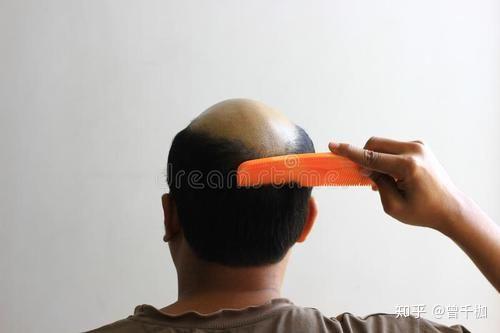 v2-36c6f40d2e47e0a80f6d719cc55a569b_r.jpg