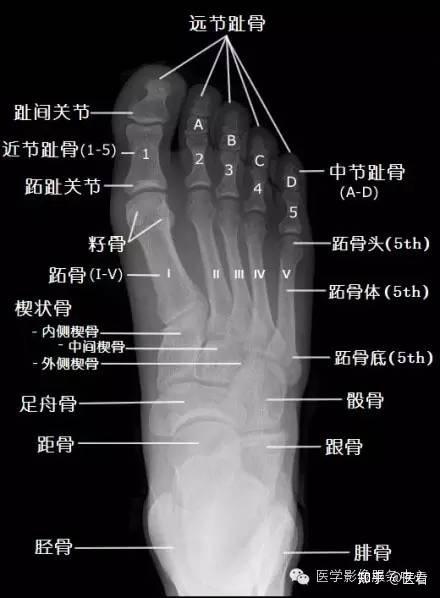 手骨骼X光图片