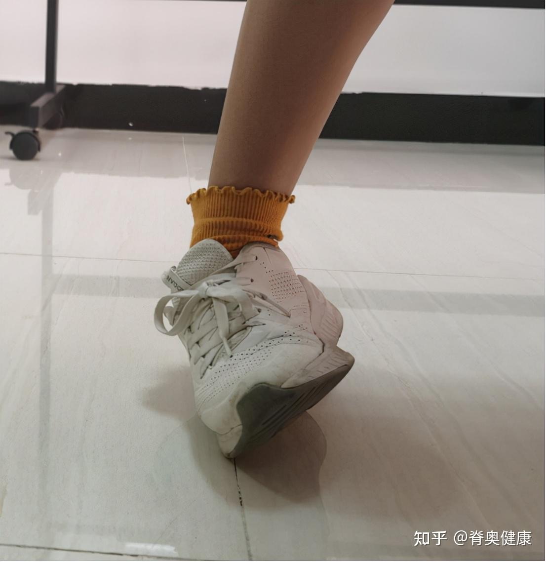 崴脚的治疗,你做对了吗? - 知乎