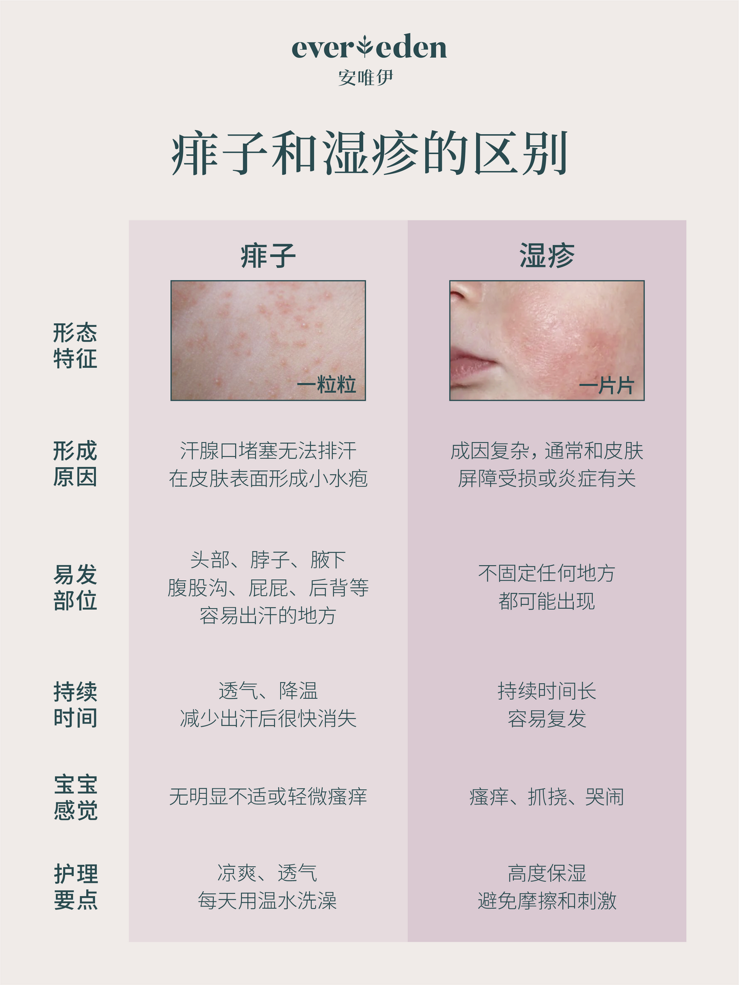 一张图看懂痱子和湿疹的区别 ️马上就分清~ - 知乎