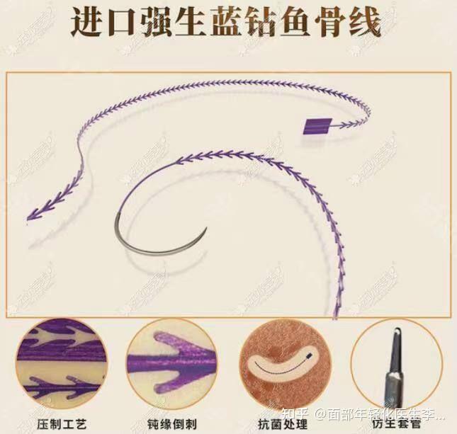 面部年轻化医生李瑞芳悦升线好还是强生鱼骨线好