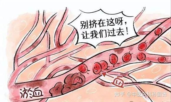 中医:阳虚久了,千万不能用桂附地黄丸,第一步应该这样做! - 知乎