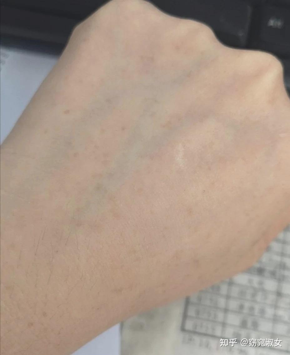 一个月就淡化了~我手上是晒斑哦!