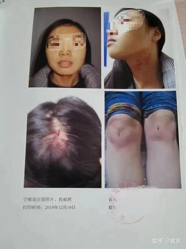 家暴系列实战篇十八:家暴无处不在,未婚女孩如何辨别家暴男! - 知乎