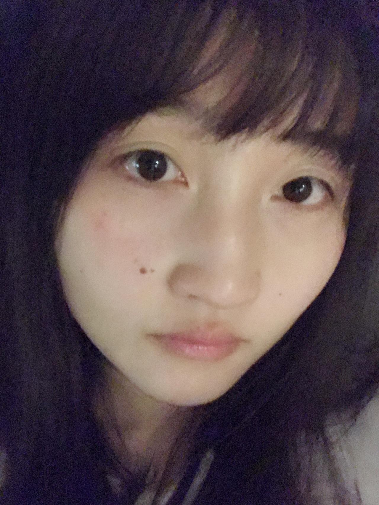 手术切痣是一种怎样的体验?