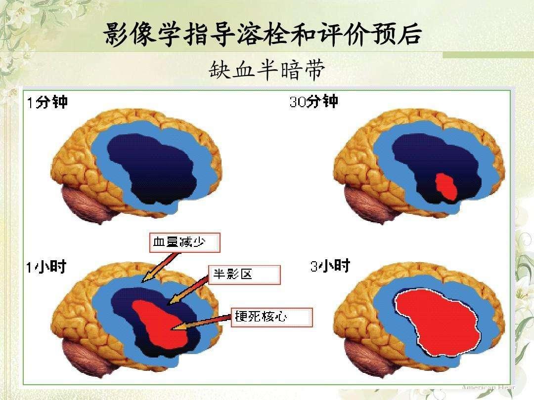 12 对颅神经分布、功能总汇|神经|导致|损伤|分布|脑干|-健康界