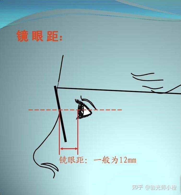 除去平时过度的用眼还与变形的镜架有很大的关系果然验光后双眼近视