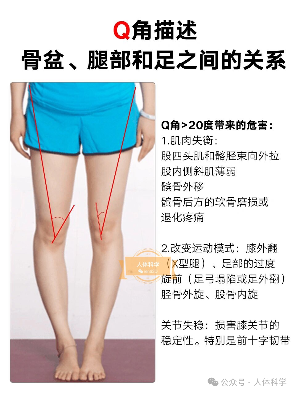 【腿型评估】如何准确检测腿部Q角大小? - 知乎