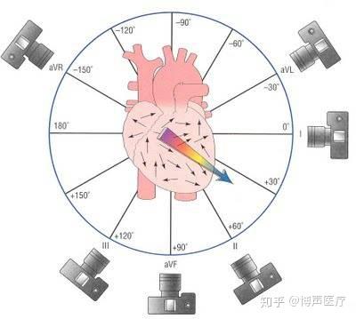 博声医疗 心电轴 心电轴右偏 知乎