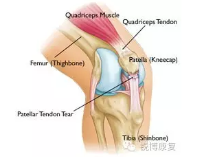 膝盖保护不好 髌腱炎跟着你跑 知乎