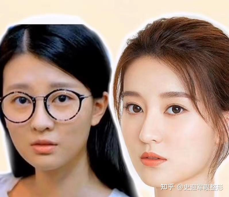 白富美乔欣从无神眼到灵气小鹿眼只差个双眼皮