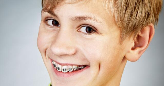 孩子牙齿长歪了,矫正的最佳年龄是多少,还是等牙齿全换完?