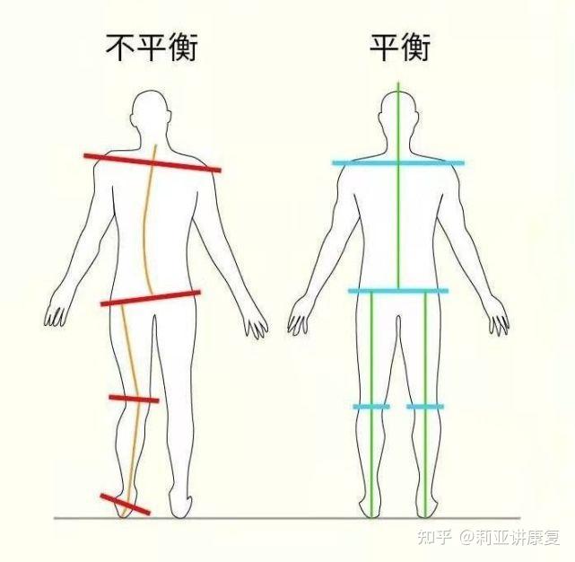 正常的下肢力线图片图片