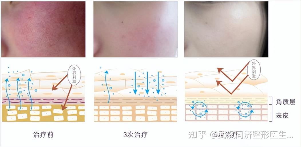 舒敏之星究竟是什么?它可以解决哪些皮肤问题? - 知乎