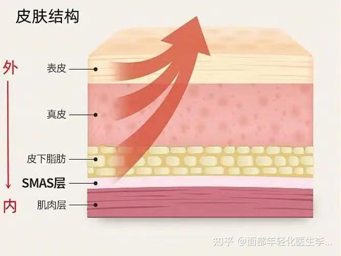 面部年輕化醫生李瑞芳悅升線相比其他線雕材質有哪些優勢