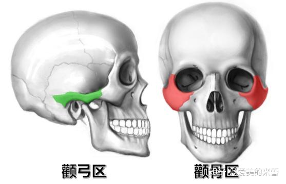 颧骨内推是怎样一种手术? - 知乎