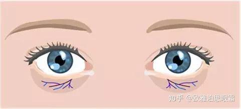 眼霜的正确使用方法,去黑眼圈眼霜排行榜推荐