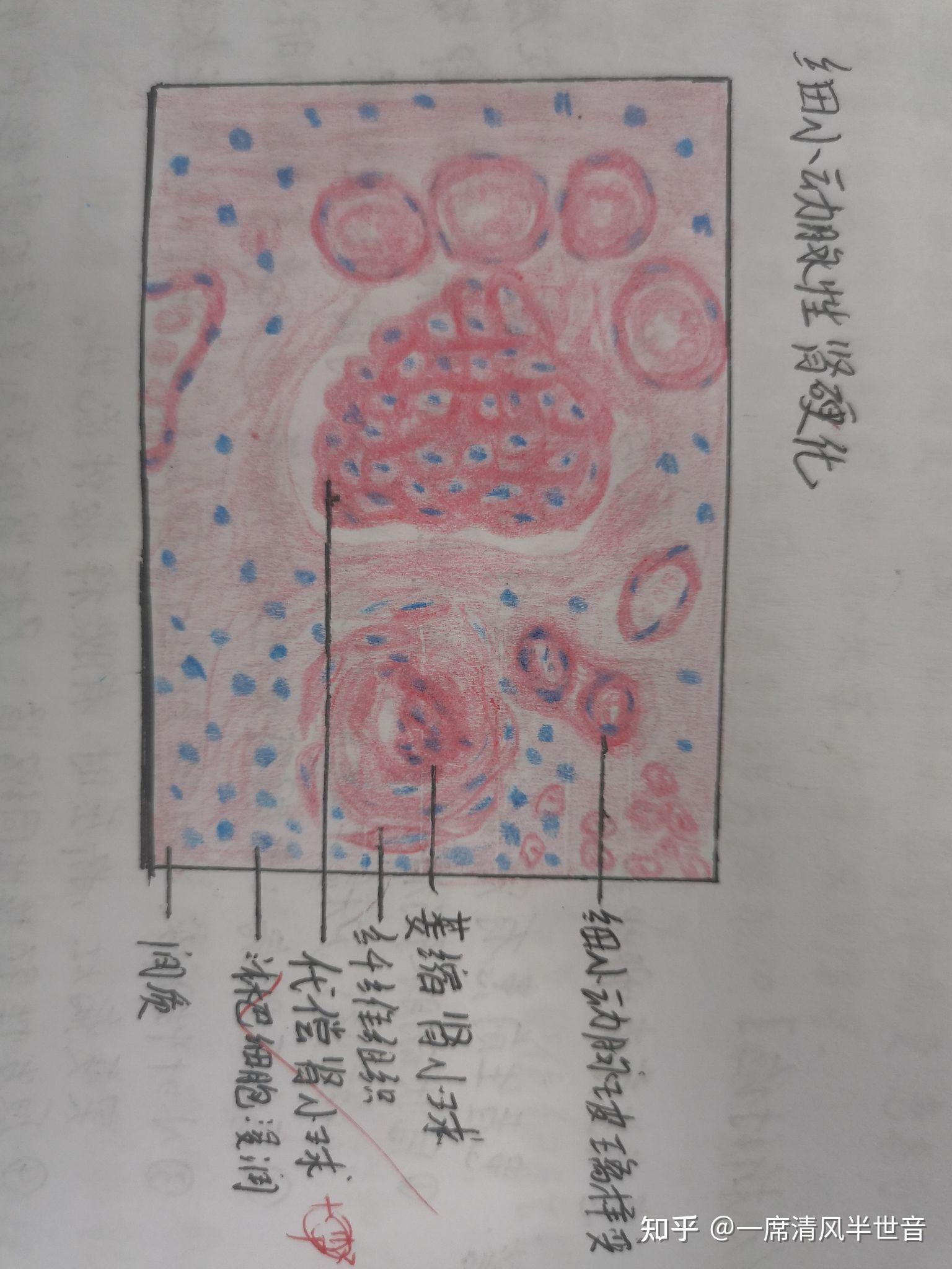 病理學實驗報告紅藍鉛筆手繪圖