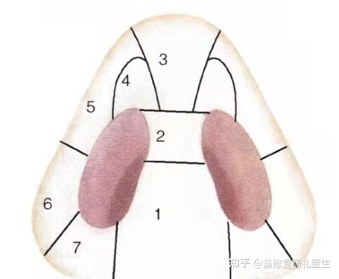 鼻小柱低;2)中央小柱;3)小叶下三角;4)软三角;5)外侧壁;6)翼底;7)鼻堤