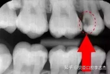 v2-3940f1981c4f4a71a1ac7d1ab3b877eb_b.jpg