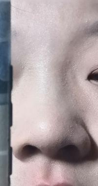 化完妆后明显看到自己脸上小小的一颗颗白色的东西,想要问是白头吗?