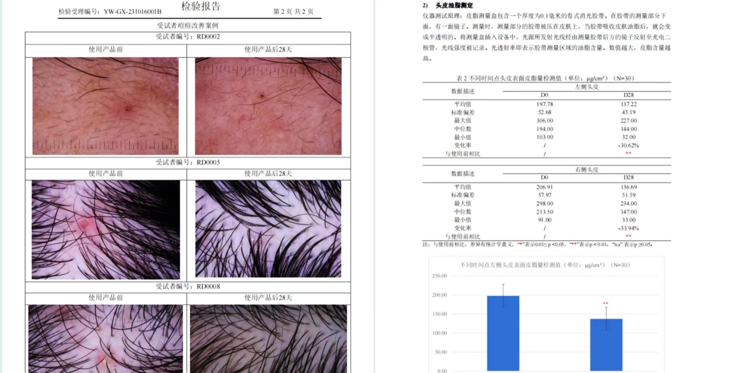 从医学角度来看,为什么头皮泛红长痘一定要抑菌除螨双管齐下? - 知乎