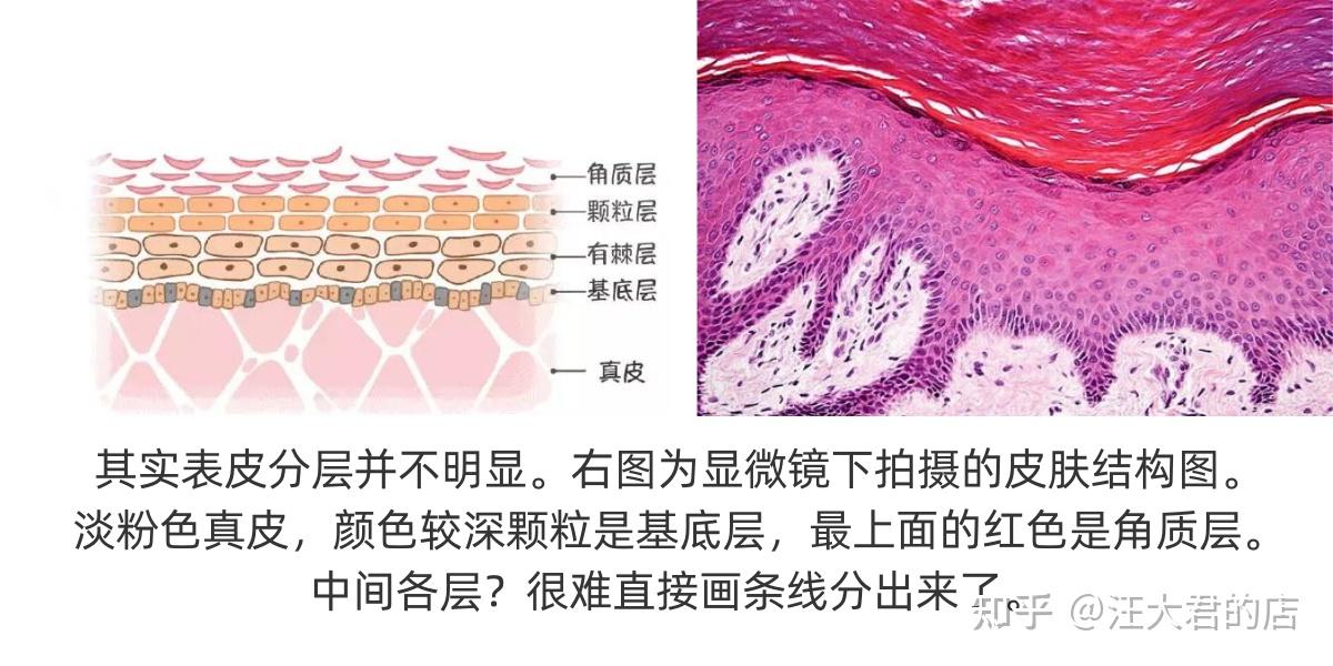 表皮层与屏障功能 - 知乎