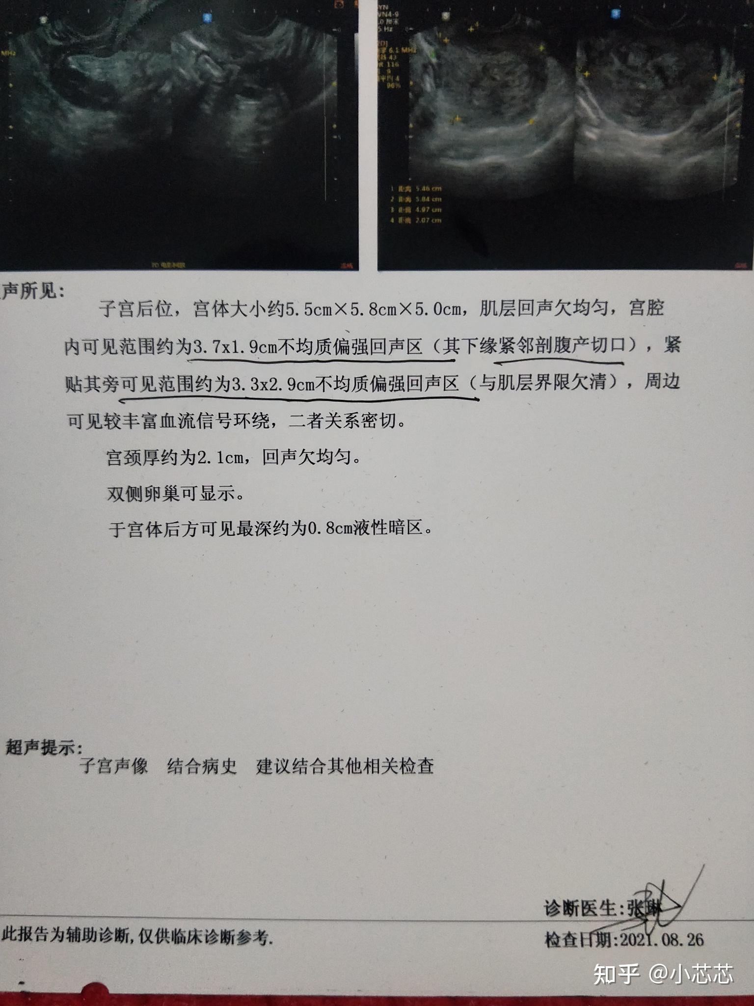 33 3 7 1 9 3 3 2 9 HCG 588 39 33-3-7-1-9-3-3-2-9-hcg-588-39