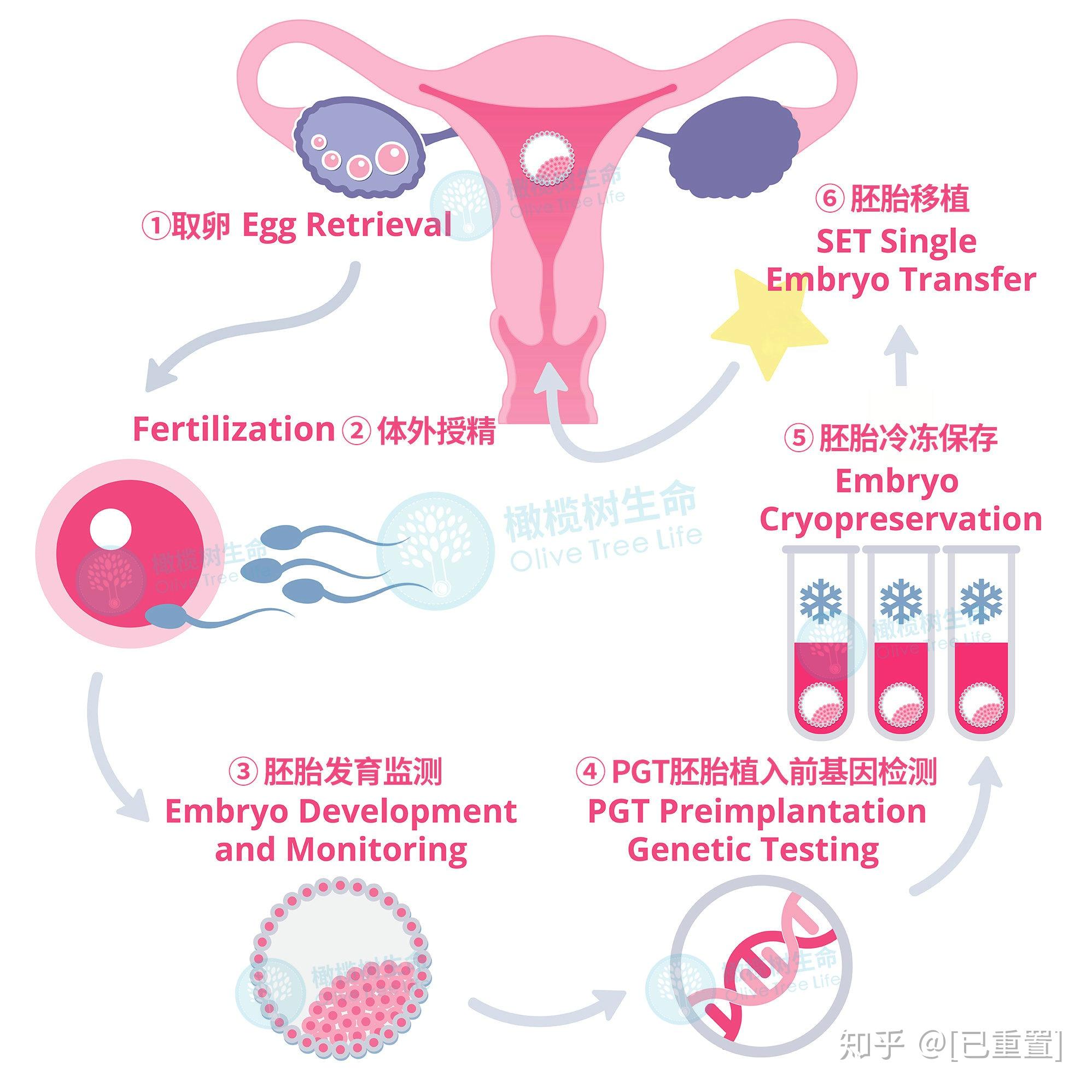 三代试管婴儿胚胎发育过程