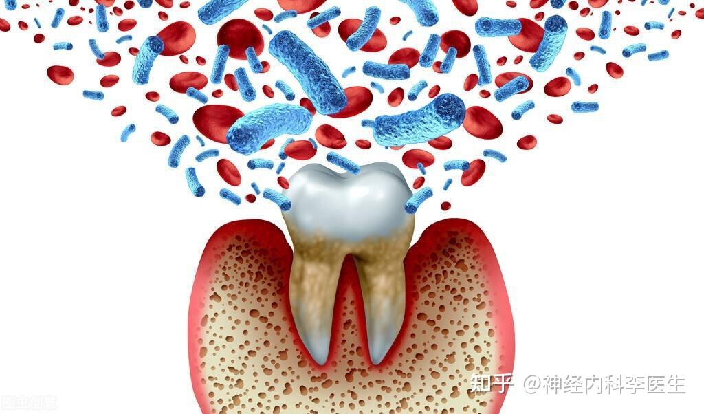 口腔疾病老是频发?可能跟糖尿病有关,日常预防需做好这5点 - 知乎