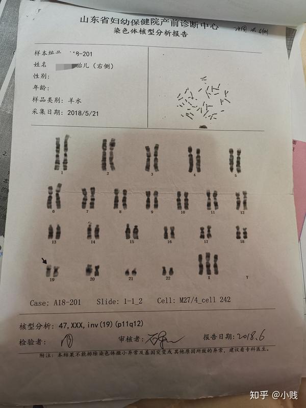 龙凤胎风险太高了47xxx宝宝是留还是流