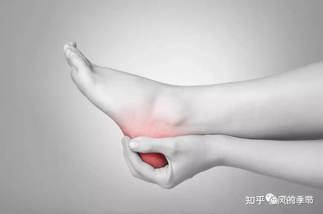 跟腱炎( 足跟疼) - 知乎