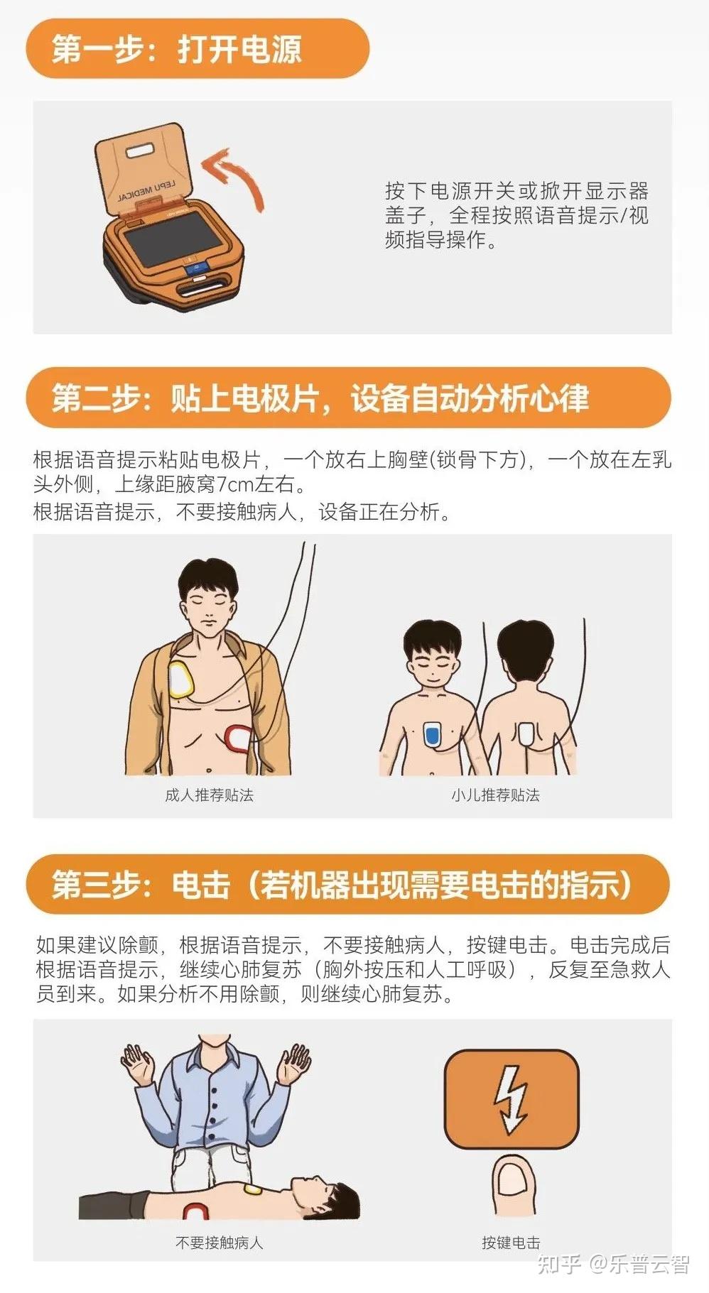 一文读懂：AED是什么急救设备？在什么情况下使用？ - 知乎