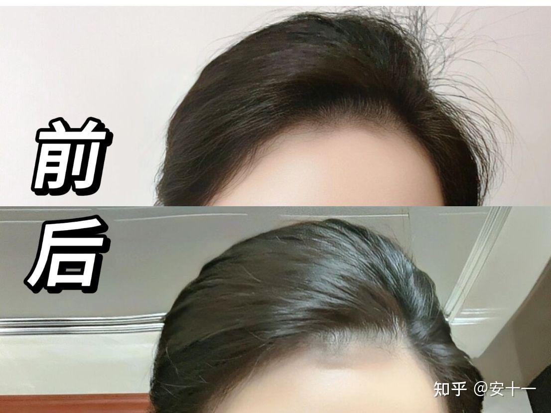 碎发太多怎么办?每天早上都要好长时间打理! - 知乎