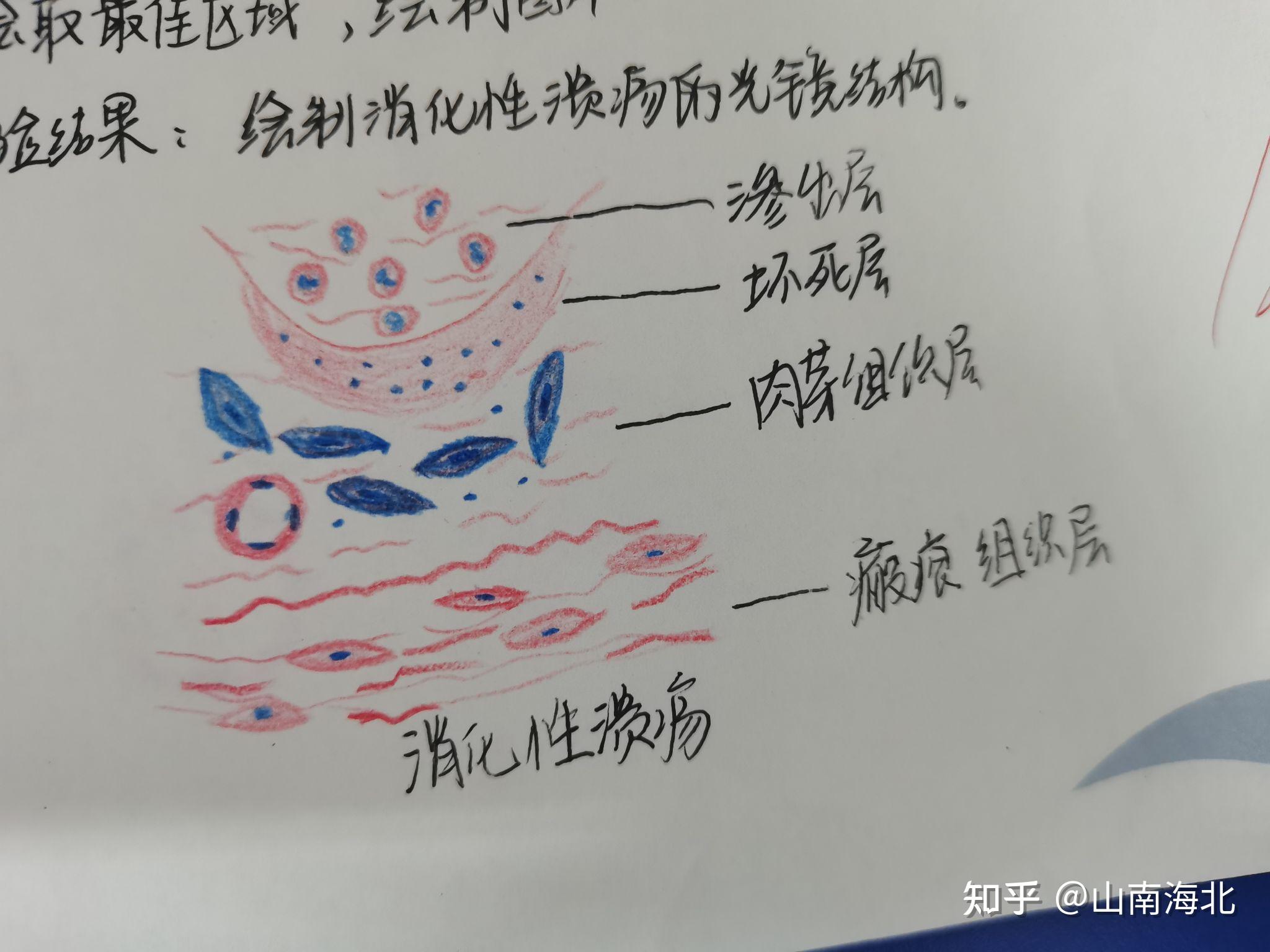 胃切片红蓝铅笔手绘图图片