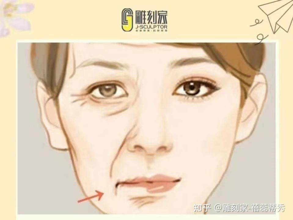 干货分享|法令纹看这一篇就够了-雕刻家/紧/致/精/华/ - 知乎