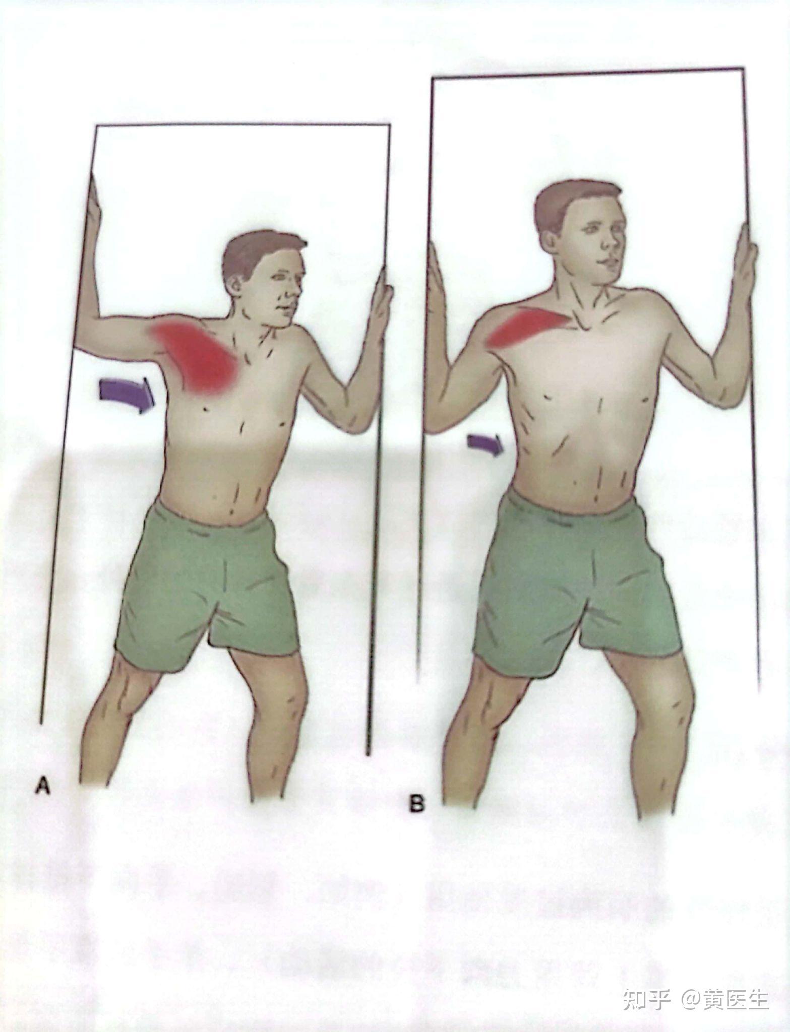 2斜方肌,肩胛提肌的牵伸训练3前锯肌的训练4斜方肌中,下束的训练5