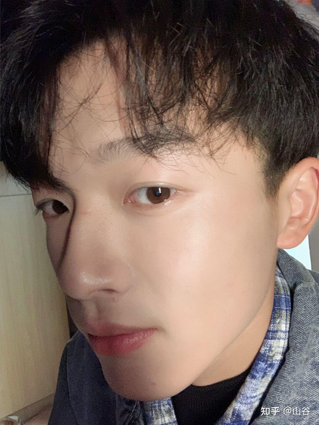 怎么能变白特别是脸男生22岁脸可黑了