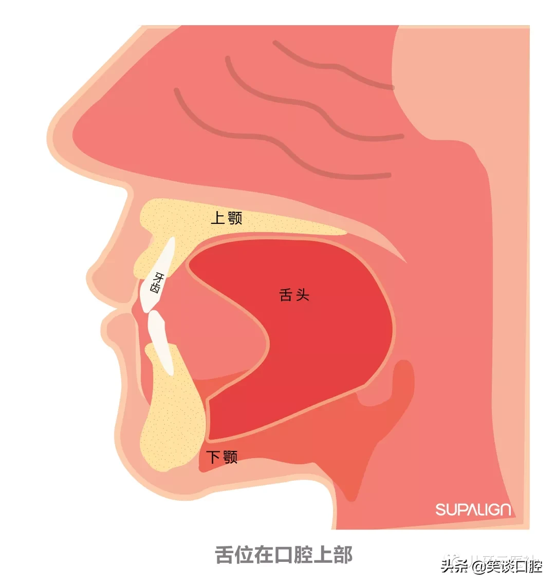 吞咽恐惧症图片