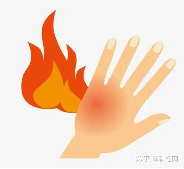 那些关于烧伤的小知识,你了解吗? - 知乎