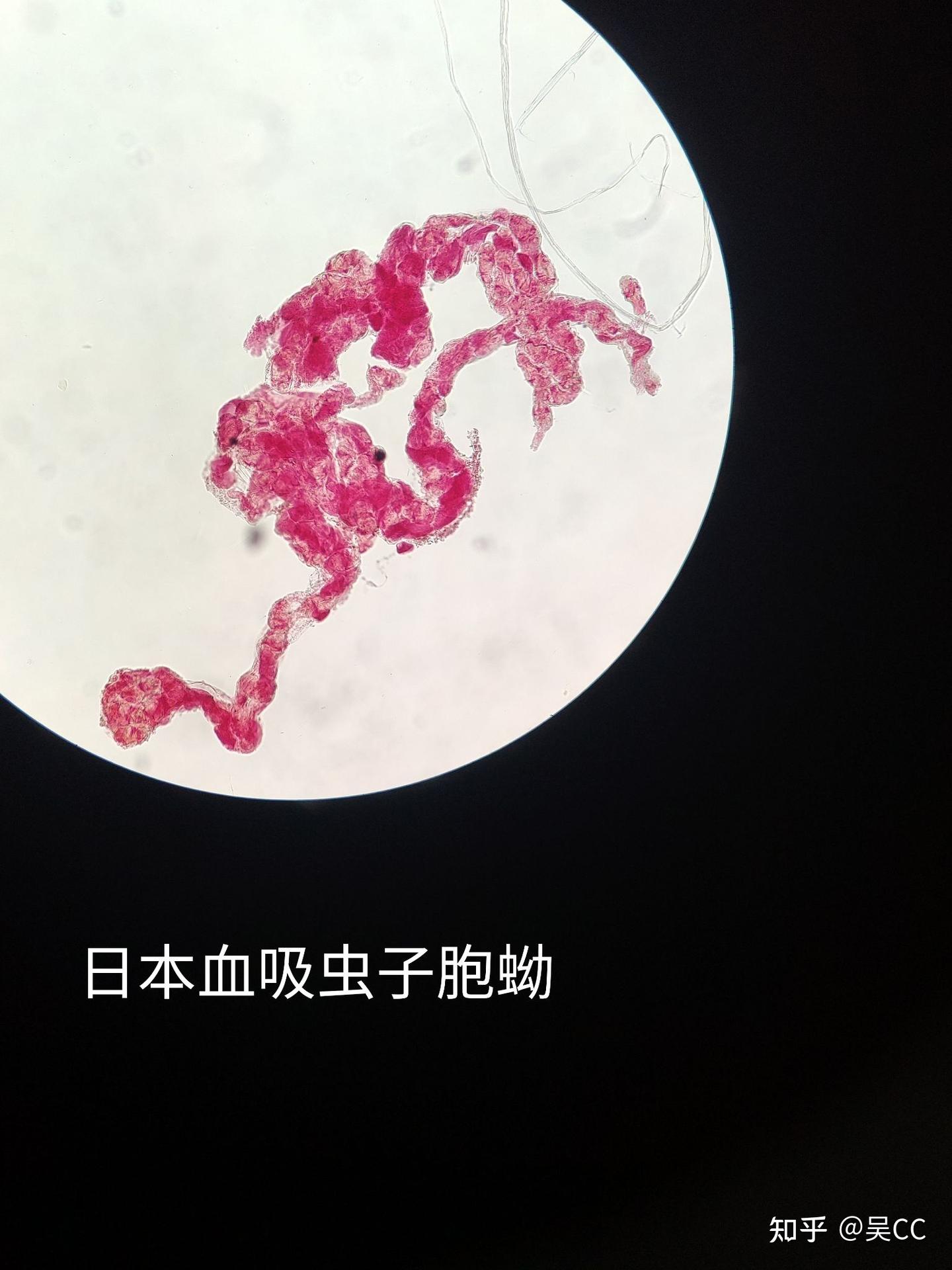 人体寄生虫学实验 - 知乎